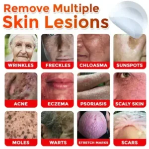 Removal Patch: Gentle Microneedle Patches for Skin Tag & Mole Removal - Image 4