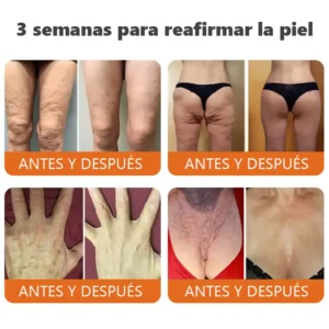 barra de esencia reafirmante con botox y veneno de abeja - Image 3