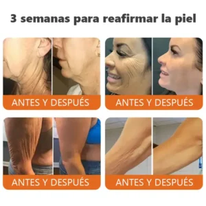 barra de esencia reafirmante con botox y veneno de abeja - Image 4
