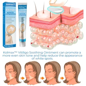Vitiligo Soothing Ointment - Image 5
