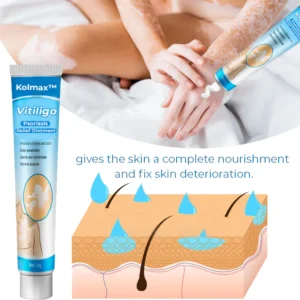 Vitiligo Soothing Ointment - Image 4