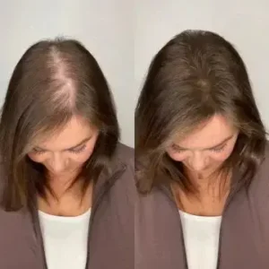 Dew of the Sea Hydrolyzed Keratin Shampoo - Image 3