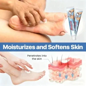 Diabetic Skin Treatment Cream - Image 6