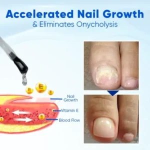 OnyxoGuard Nail Growth and Repair Serum - Image 3