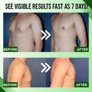 Gynecomastia Tightening Cream - Image 3