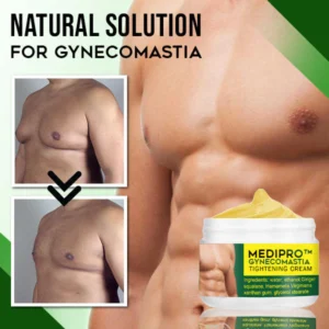 Gynecomastia Tightening Cream - Image 5