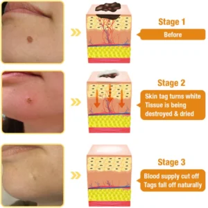 Tag Recede Bee Venom Treatment Spray - Image 5