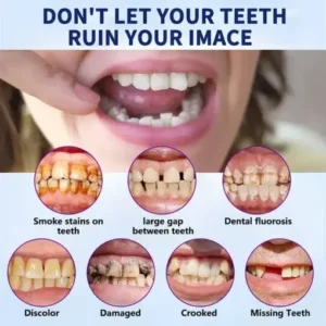 - Advanced Customized Full Denture Set - Image 10