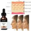 Fast Dark Spot Remover