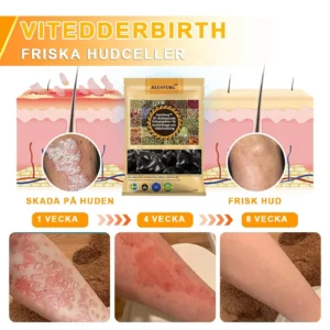 Lymphatic Drainage Foot Bath for Weight Loss - Image 9