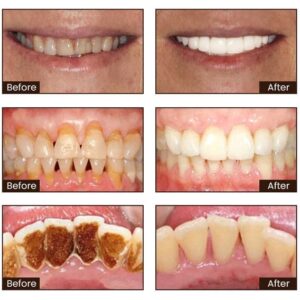 Niacinamide Intensive Whitening Toothpaste - Image 3