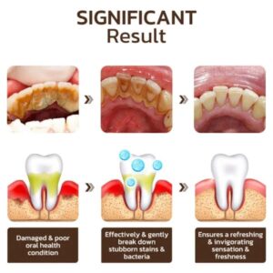 Niacinamide Intensive Whitening Toothpaste - Image 5