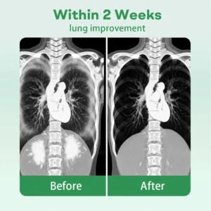 Herbal Lung Cleansing Inhaier - Image 3
