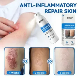 QIAWI Magnesium Herbal Psoriasis Spray - Image 2