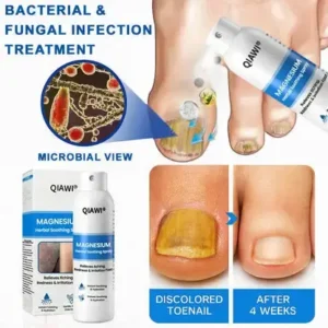 QIAWI Magnesium Herbal Psoriasis Spray - Image 9