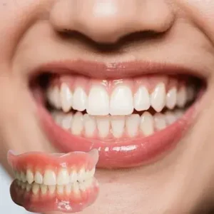 Dentures–Smile Confidently Again in Just 3 Minutes – No Dentist Needed! - Image 3