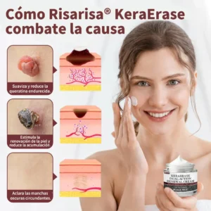 KeraErase Crema Renovadora de Doble Acción - Image 2