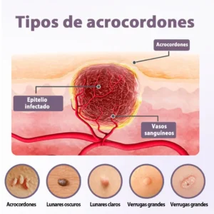 WartSmooth – Sérum Renovador para la Piel - Image 3