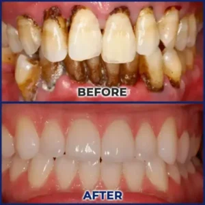 BeeTakt Bee Venom Dental Treatment Drops Mouthwash - Image 11