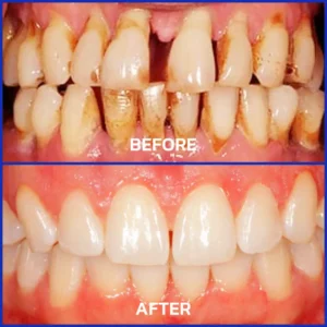 VioCore Bee Venom Dental Treatment Toothpaste - Image 11