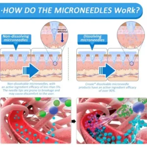Nano Microneedle Patch - Image 12