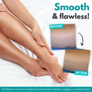 Hair Removal Spray - Image 4