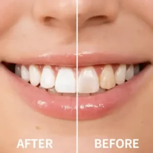 — Instantly Whiter Smile - Image 5