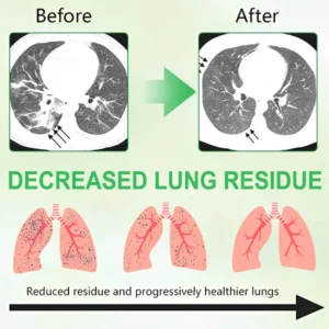 3X Concentrated Mullein Lung Cleanse Spray - Image 4