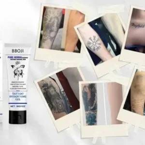Tattoo Removal Cream - Fast Painless & Scar-Free Tattoo Erasure - Image 10