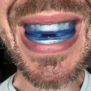 The Quiet Anti-Snoring Mouthpiece Universal Size - Image 8
