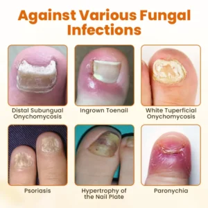 FungiBee Advanced Nail Repair Spray - Image 7