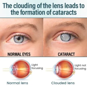 OptiFusion Nano Eye Drops Serum - Image 5