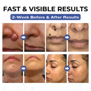 VanishPro Skin Spot Removal Cream - Image 2