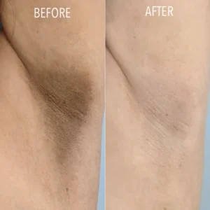 Dark Spot Correcting Cream - Image 3