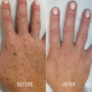 Dark Spot Correcting Cream - Image 4
