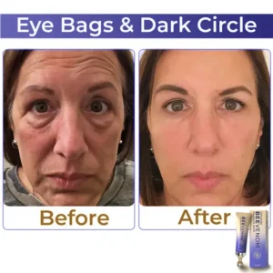 Collagen+ Bee Venom Roller Eye Cream - Image 2