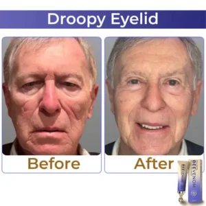 Collagen+ Bee Venom Roller Eye Cream - Image 3