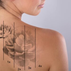 Permanent Tattoo Removal Cream - Image 6