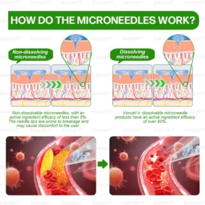 𝑴𝒐𝒓𝒊𝒏𝒈𝗮 · 𝗕𝗲𝗿𝗯𝗲𝗿𝙞𝙣𝙚 × 𝑬𝑮𝑪𝑮 10-in-1 Advanced Nano Microneedle Patch - Image 22