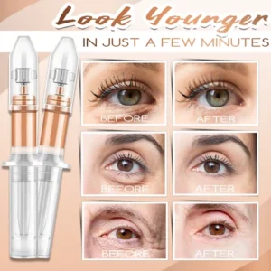 120 Sec Eye Bags Removal Cream - Image 5