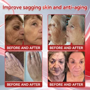 𝐂𝐨𝐥𝐥𝗮𝗴𝗲𝗻 𝐏𝐞𝐩𝘁𝗶𝗱𝗲𝘀 𝐖𝐞𝐢𝗴𝗵𝘁 𝐋𝐨𝐬𝐬 & 𝗙𝗶𝗿𝗺𝗶𝗻𝗴 𝐎𝐫𝐚𝒍 𝐒𝐨𝐥𝐮𝒕𝒊𝒐𝒏 𝐖𝐢𝐭𝐡 𝐂𝐨𝐥𝐥𝗮𝗴𝗲𝗻 𝐏𝐞𝐩𝘁𝗶𝗱𝗲𝘀 - Image 7