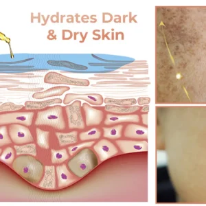 Fast Dark Spot Remover - Image 5