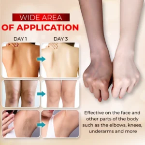 3 Days Kojic Acid Whitening Moisturizing Cream - Image 7