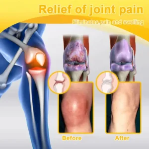 Botulinum Toxin and Bee Venom Pain Relief Bone Healing Cream - Image 10