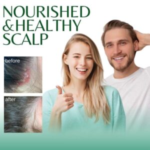 Seborrheic Dermatitis Spray - Image 3