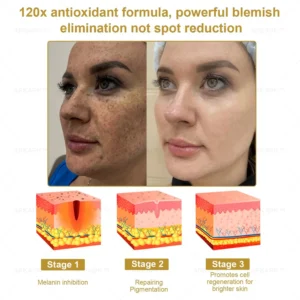 Effective All-in-One Skin Treatment Cream - Image 3