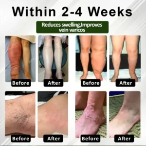 CircuHerb Edema Soothing & Healing Balm - Image 13
