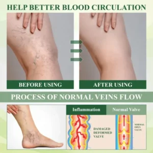 CircuHerb Edema Soothing & Healing Balm - Image 8