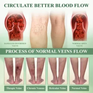 CircuHerb Edema Soothing & Healing Balm - Image 9