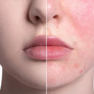 ATTDX Color Correcting Treatment Cream - Image 2